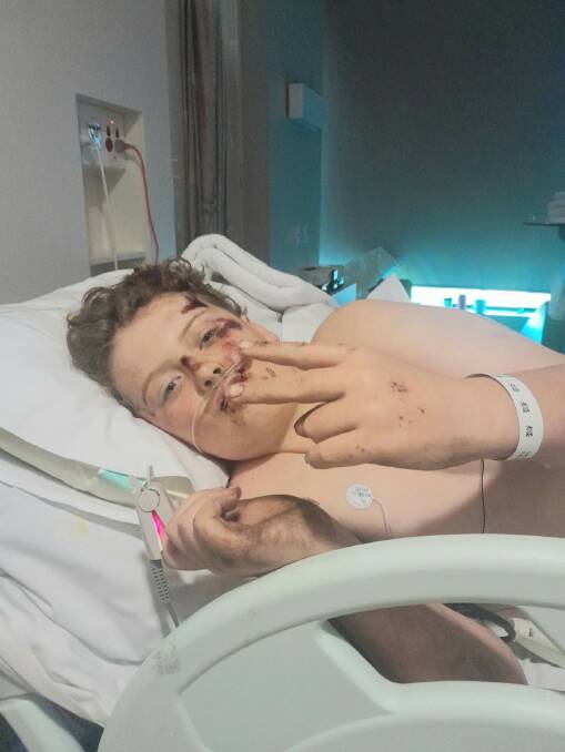 Lennox Watson, 11, is recovering in the Royal Children's Hospital after he was hit by a car in Warrnambool on Friday. Picture supplied